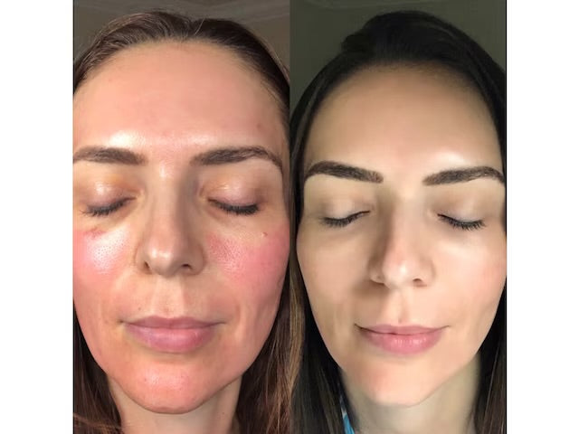 CO2 Lift Pro Carboxy Gel Mask 3 Applications