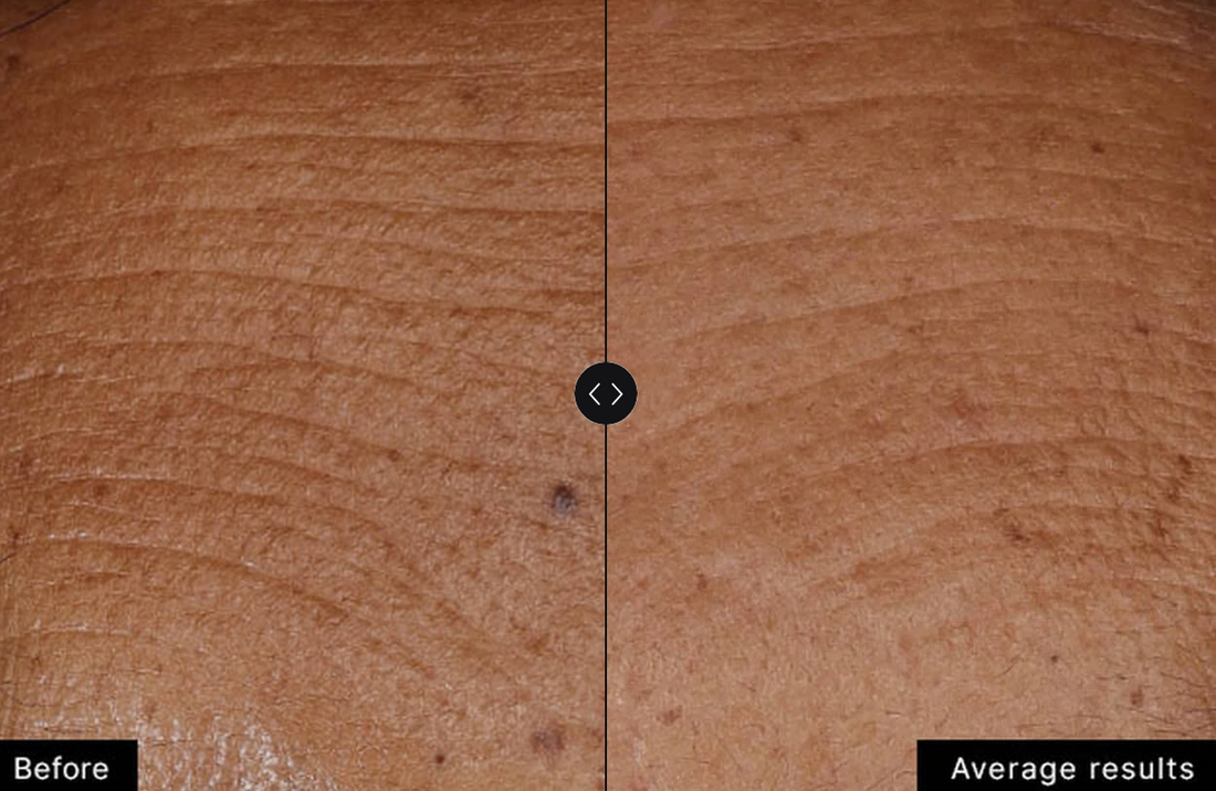 Hyaluronic Acid Intensifier Multi-Glycan