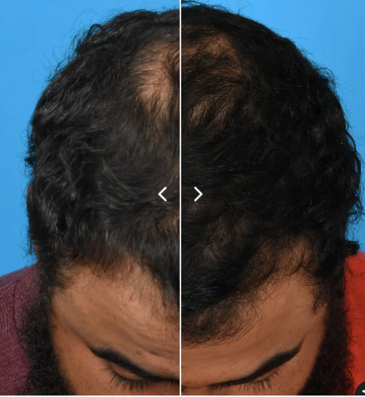 Plated Hair Serum