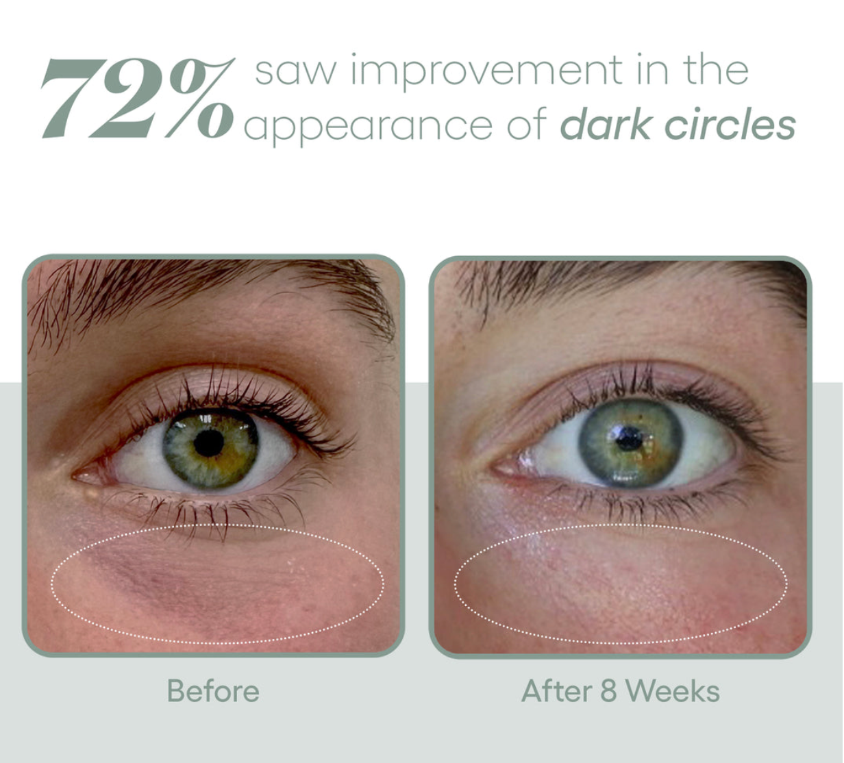 (Plated)-Eye Serum