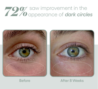 (Plated)-Eye Serum